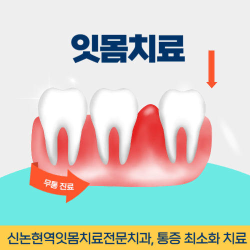 진주치과 진주시 치과 잇몸치료